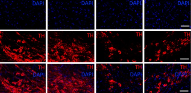 Molécula anti-inflamatória mostra potencial contra Parkinson em estudo com camundongos