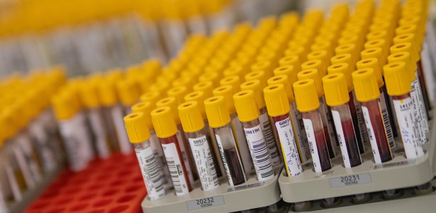 Exame de sangue poderá antecipar o risco de hipertensão pulmonar