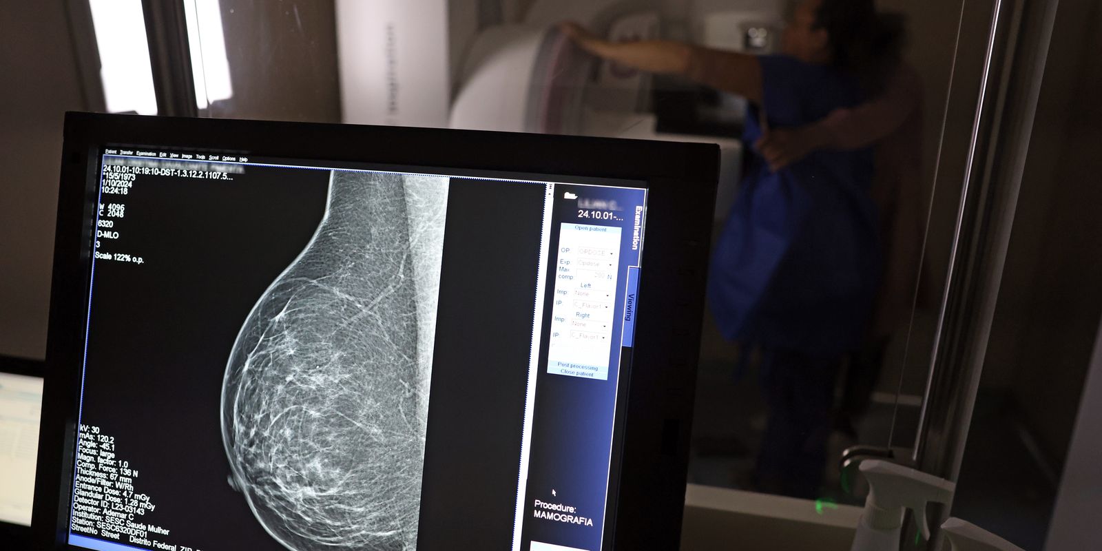 Entidades alertam médicos sobre pedidos de mamografia digital