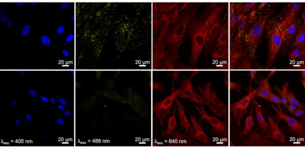 Pesquisadores obtêm avanço em técnica de imagem biomédica e tratamento de câncer