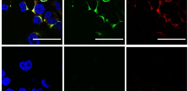 Cientistas usam ultrassom para estourar vírus da influenza A e da COVID-19 sem danificar células humanas
